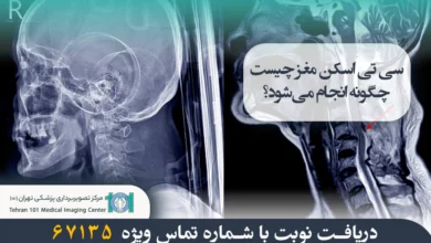 سی تی اسکن گردن چیست؟ بررسی کامل کاربردها، دلایل انجام و مراحل آن 8 سی تی اسکن گردن چیست؟