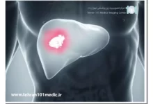 تشخیص و درمان بیماریهای کبد با ام آر ای 11 ام آر آی کبد