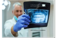 انواع رادیوگرافی دندان 22 رادیوگرافی دندان
