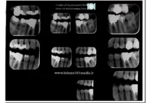 هزینه رادیوگرافی دندان 21 هزینه رادیوگرافی دندان