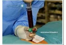 بیوپسی چیست؟ 54 بیوپسی چیست