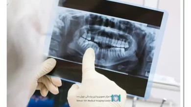 رادیولوژی فک و صورت 25 رادیولوژی فک و صورت