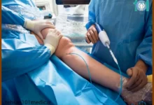 آنژیوگرافی عروق محیطی چیست؟ 17 آنژیوگرافی عروق محیطی چیست؟