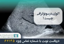 اکوژن در سونوگرافی چیست و توده اکوژن چه مفهومی دارد؟ 39 اکوژن در سونوگرافی چیست؟